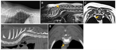 Case Report: Spinal Stabilization Surgery Using a Novel Custom-Made Titanium Fixation System for the Spinal Instability Caused by Vertebral Malformation in a Dog